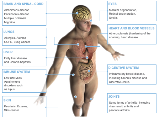 Chronic Inflammation Diagram